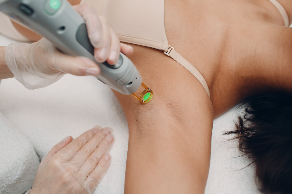 laser hair removal armpit