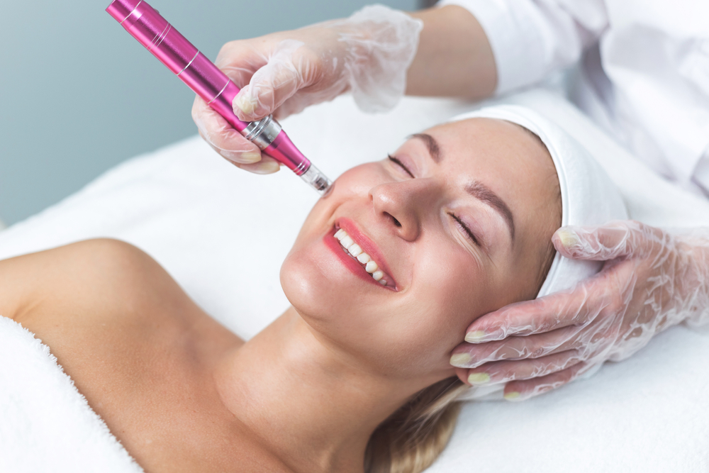 Is Microneedling Worth It